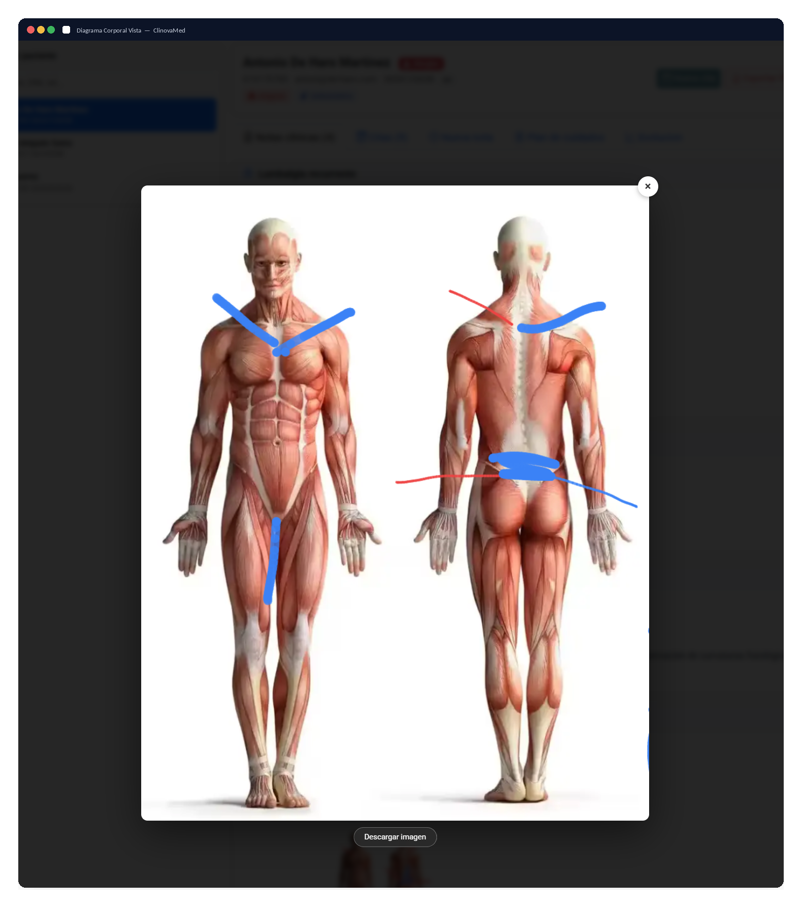 Diagrama Corporal